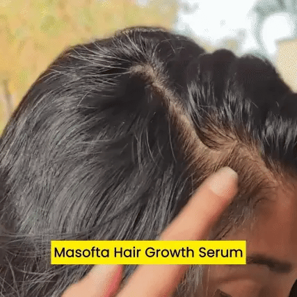 Get 70% off Advanced Hair Growth Serum (90 ml) 1 get 2 free