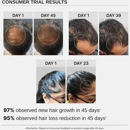 Get 70% off Advanced Hair Growth Serum (90 ml) 1 get 2 free