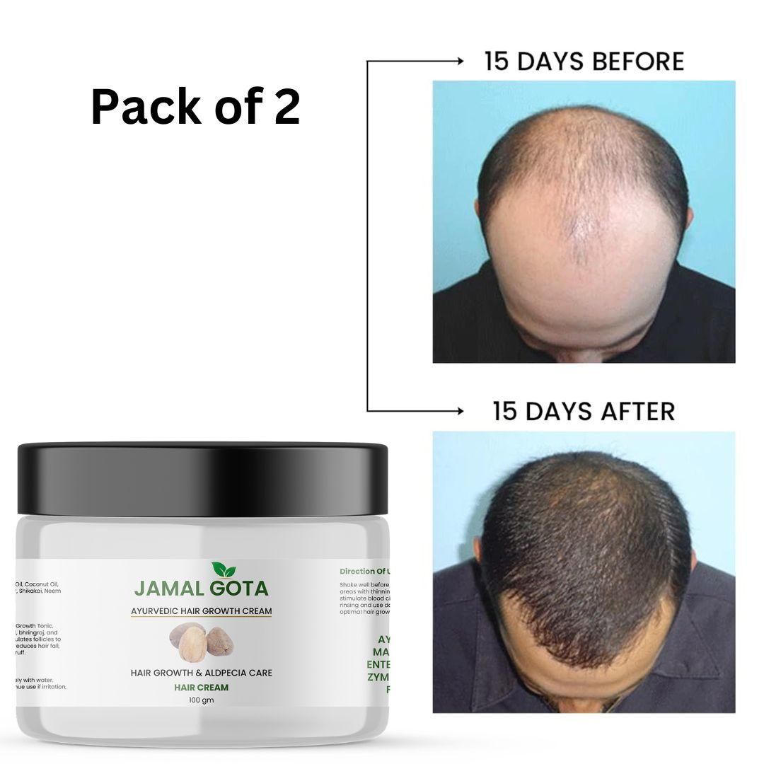 Jamalgota Ayurvedic Hair Growth Cream 100gm (Pack of 2) by 1 get 1 free